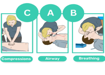 7 Expert Steps for What Should You Do When Giving Chest Compressions: The Ultimate Life-Saving Guide