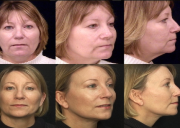 10 Must-Know Tips About Destin Plastic Surgeons From Trusted Experts